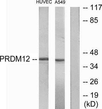 PRDM12 rabbit pAb Antibody