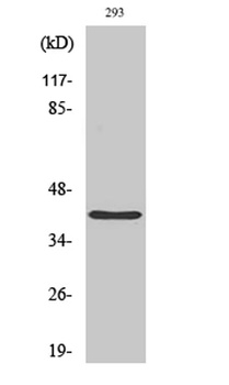 PRPF18 rabbit pAb Antibody