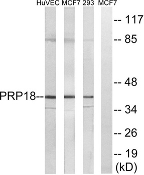 PRPF18 rabbit pAb Antibody