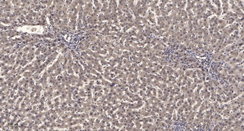 PRPF18 rabbit pAb Antibody