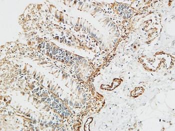 Ptx3 rabbit pAb Antibody