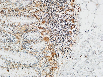 Ptx3 rabbit pAb Antibody