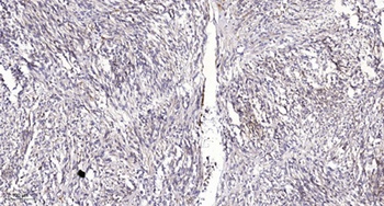 Rabenosyn-5 rabbit pAb Antibody
