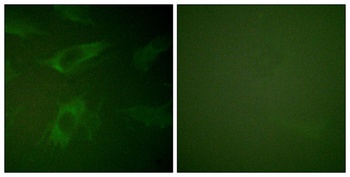 Rabphilin-3A rabbit pAb Antibody