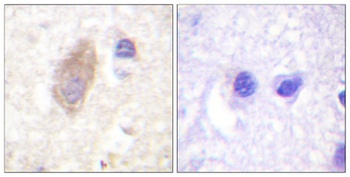 Rabphilin-3A rabbit pAb Antibody