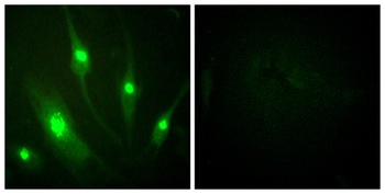 Rac GAP1 rabbit pAb Antibody