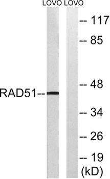 Rad51 rabbit pAb Antibody