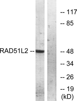 Rad51C rabbit pAb Antibody