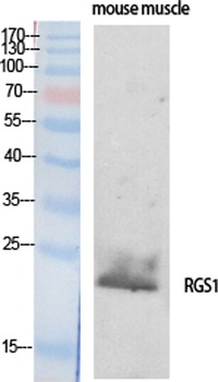 RGS1 rabbit pAb Antibody