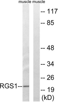 RGS1 rabbit pAb Antibody