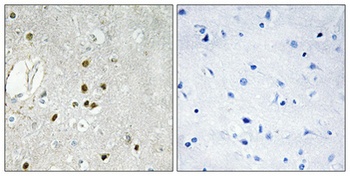 Ribosomal Protein L27A rabbit pAb Antibody