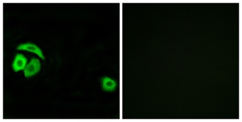 Ribosomal Protein L27A rabbit pAb Antibody