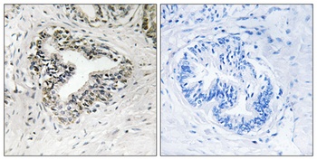 Ribosomal Protein L30 rabbit pAb Antibody