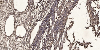 Ribosomal Protein S2 rabbit pAb Antibody