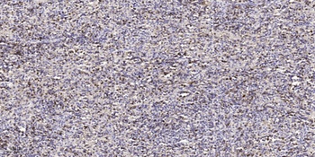 RKIP rabbit pAb Antibody