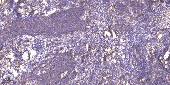 RNF130 rabbit pAb Antibody