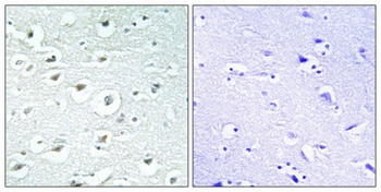 RoXaN rabbit pAb Antibody