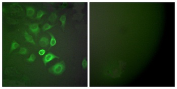 S-100 α rabbit pAb Antibody