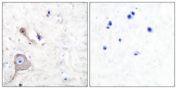 S-100 α rabbit pAb Antibody