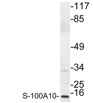 S-100A10 rabbit pAb Antibody