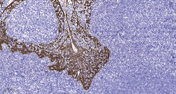 SAPAP1 rabbit pAb Antibody