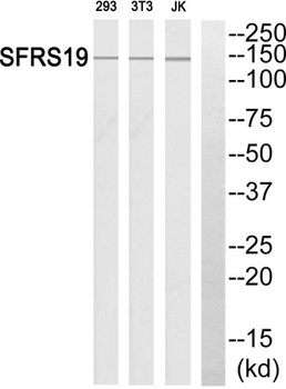 SCAF1 rabbit pAb Antibody