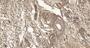 SCAF1 rabbit pAb Antibody