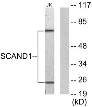 SCAND1 rabbit pAb Antibody