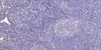 SCAND1 rabbit pAb Antibody