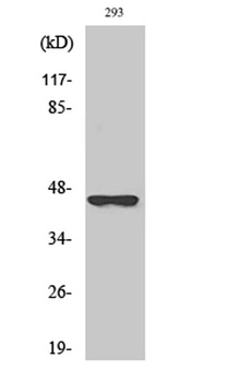 SCCA2 rabbit pAb Antibody