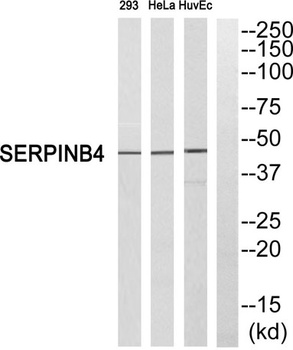 SCCA2 rabbit pAb Antibody