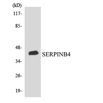 SCCA2 rabbit pAb Antibody