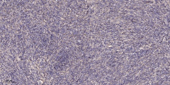SCCA2 rabbit pAb Antibody