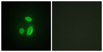 Separase rabbit pAb Antibody