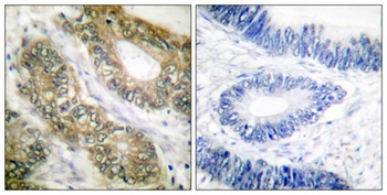 Separase rabbit pAb Antibody
