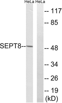 Septin 8 rabbit pAb Antibody