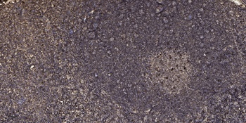 Septin 8 rabbit pAb Antibody