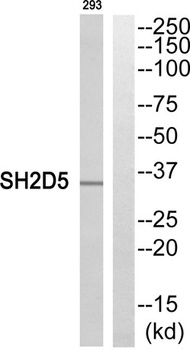 SH2D5 rabbit pAb Antibody