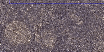 SH2D5 rabbit pAb Antibody