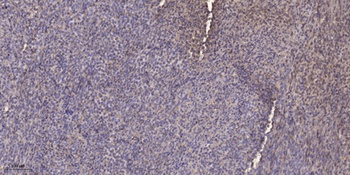SH-PTP1 rabbit pAb Antibody