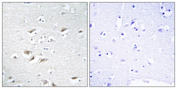 SIP1 rabbit pAb Antibody