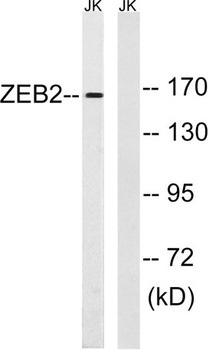SIP1 rabbit pAb Antibody