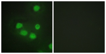 Six3/6 rabbit pAb Antibody