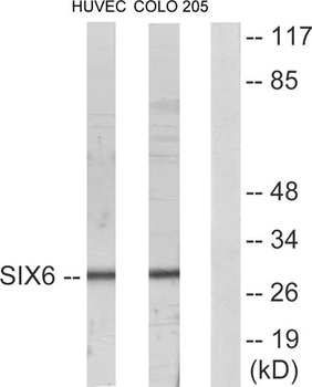 Six3/6 rabbit pAb Antibody