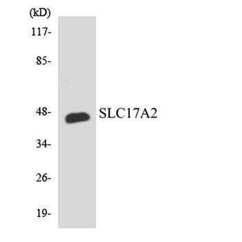 SLC17A2 rabbit pAb Antibody