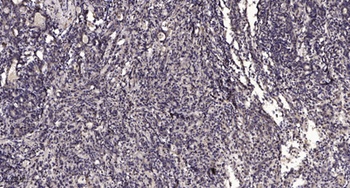 SLC17A2 rabbit pAb Antibody