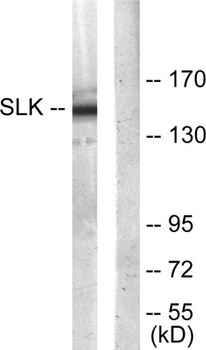 SLK rabbit pAb Antibody