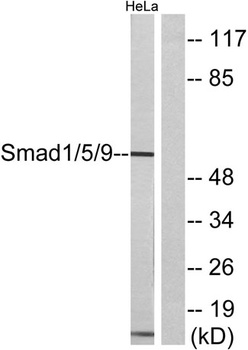 Smad1/5/9 rabbit pAb Antibody