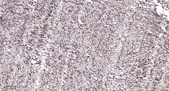 Smad1/5/9 rabbit pAb Antibody