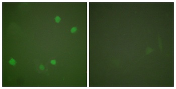 SMAP45 rabbit pAb Antibody